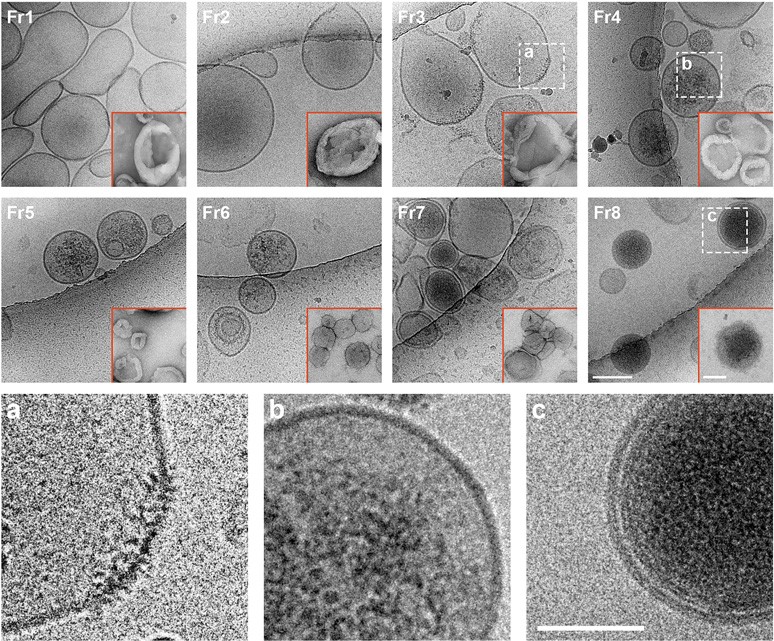 Mitochondria Derived Mitovesicles in Down Syndrome